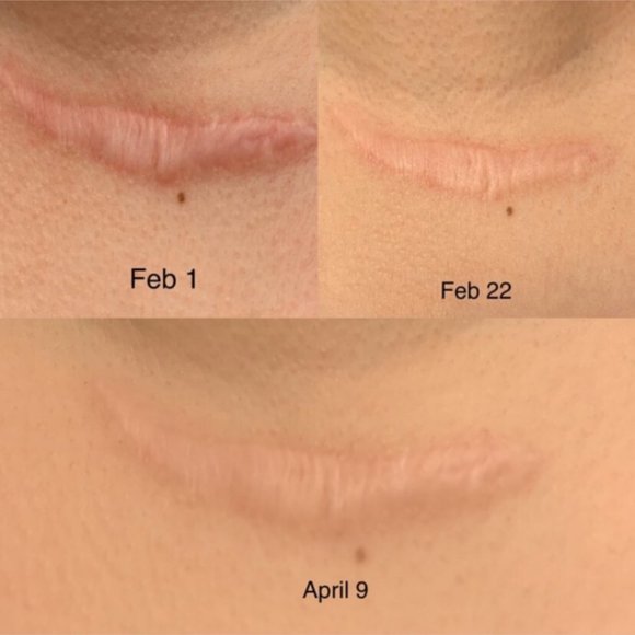 Koffee Beauty Scrub - Picture 11 of 11